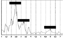 nigm5b.tif