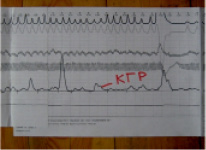 kud2.tif