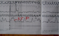 kud3.tif
