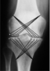 svir1a.tif