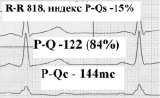 vorob2.tif