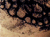 hihl1a.tif