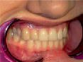 dmit1.tif
