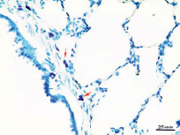 suh1a.tif